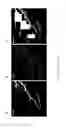 Fig. 07 - Venule endothelial cell genes and uses thereof