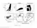 Fig. 09 - Venule endothelial cell genes and uses thereof