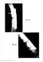Fig. 02 - Formulation for regeneration of bone, cartilage, teeth, and periodontium and treatment of tumors and cysts