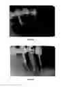 Fig. 06 - Formulation for regeneration of bone, cartilage, teeth, and periodontium and treatment of tumors and cysts