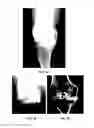 Fig. 07 - Formulation for regeneration of bone, cartilage, teeth, and periodontium and treatment of tumors and cysts
