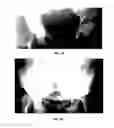 Fig. 08 - Formulation for regeneration of bone, cartilage, teeth, and periodontium and treatment of tumors and cysts