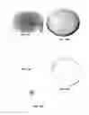 Fig. 22 - Formulation for regeneration of bone, cartilage, teeth, and periodontium and treatment of tumors and cysts