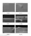 Fig. 03 - Implants with wear resistant coatings and methods
