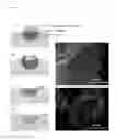 Fig. 09 - BONE PASTES COMPRISING BIOFUNCTIONALIZED CALCIUM PHOSPHATE CEMENTS WITH ENHANCED CELL FUNCTIONS FOR BONE REPAIR