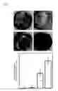 Fig. 13 - BONE PASTES COMPRISING BIOFUNCTIONALIZED CALCIUM PHOSPHATE CEMENTS WITH ENHANCED CELL FUNCTIONS FOR BONE REPAIR