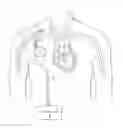 Fig. 01 - Devices, methods and systems for counterpulsation and blood flow conduit connection