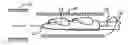 Fig. 01 - Heart assist device with expandable impeller pump