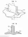 Fig. 06 - Heart assist device with expandable impeller pump