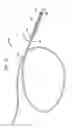 Fig. 12 - Heart assist device with expandable impeller pump
