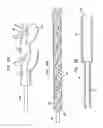 Fig. 13 - Heart assist device with expandable impeller pump