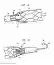 Fig. 16 - Heart assist device with expandable impeller pump