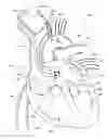 Fig. 01 - Ventricular assist device and related methods