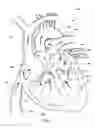 Fig. 02 - Ventricular assist device and related methods