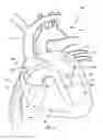 Fig. 03 - Ventricular assist device and related methods