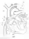 Fig. 04 - Ventricular assist device and related methods