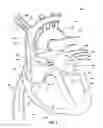 Fig. 07 - Ventricular assist device and related methods