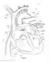 Fig. 08 - Ventricular assist device and related methods