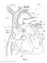 Fig. 10 - Ventricular assist device and related methods