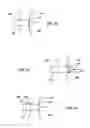 Fig. 13 - Ventricular assist device and related methods
