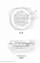 Fig. 06 - Wound treatment apparatus and method
