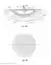 Fig. 16 - Wound treatment apparatus and method