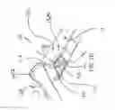 Fig. 07 - Catheter devices with needle guards and related methods
