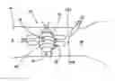 Fig. 01 - Device and method for the reduction of pain associated with needle sticks