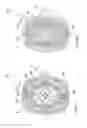 Fig. 56 - Semi disposable auto injector