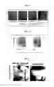 Fig. 14 - Fluid delivery devices and methods