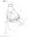 Fig. 02 - Nebulizer and nebulizer kit