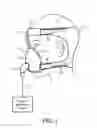 Fig. 02 - 3-D patient interface device adjustment system and method