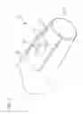Fig. 04 - Systems and methods to increase rigidity and snag-resistance of catheter tip
