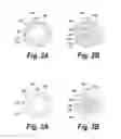 Fig. 03 - Body lumen fluid delivery device