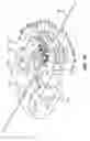 Fig. 33 - Active drives for robotic catheter manipulators