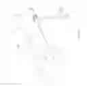 Fig. 07 - VASCULAR ACCESS CONFIGURATION