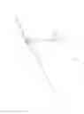 Fig. 10 - VASCULAR ACCESS CONFIGURATION