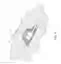Fig. 09 - Implantable venous device