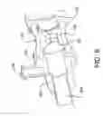 Fig. 10 - Valve assembly for medical procedures