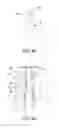 Fig. 06 - Skin-forming apparatus and method