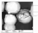 Fig. 01 - Porous propylene polymers