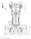 Fig. 02 - Self-lubricating bushings