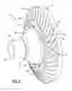 Fig. 02 - DIFFERENTIAL ASSEMBLY WITH SINGLE WELD JOINT CONNECTING TWO-PIECE DIFFERENTIAL CASE AND RING GEAR