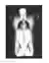 Fig. 01 - Unsupervised training for an atlas-based registration