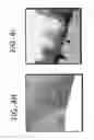 Fig. 10 - System and method for perspective preserving stitching and summarizing views