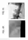 Fig. 12 - System and method for perspective preserving stitching and summarizing views