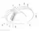 Fig. 02 - FERRULE FOR IMPLANTABLE MEDICAL DEVICE