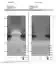 Fig. 06 - Metal oxide semiconductor having epitaxial source drain regions and a method of manufacturing same using dummy gate process