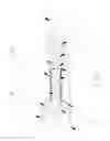 Fig. 01 - ELECTRONIC CIGARETTE, ATOMIZER ASSEMBLY AND ELECTRICAL CONNECTION STRUCTURE THEREOF