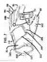 Fig. 08 - Golf gloves